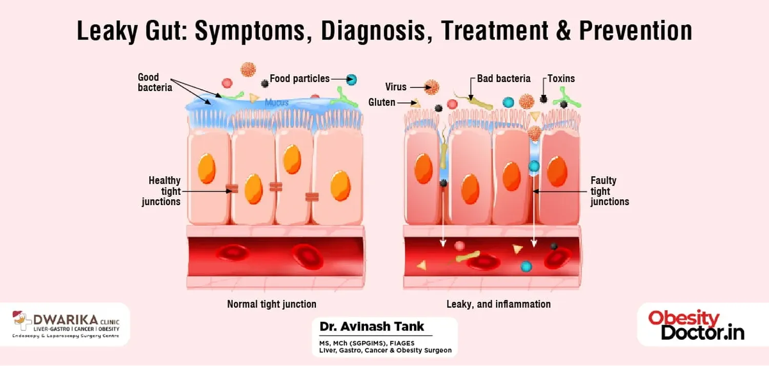 How to fix leaky gut and liver inflammation through specific dietary changes and targeted amino acid support