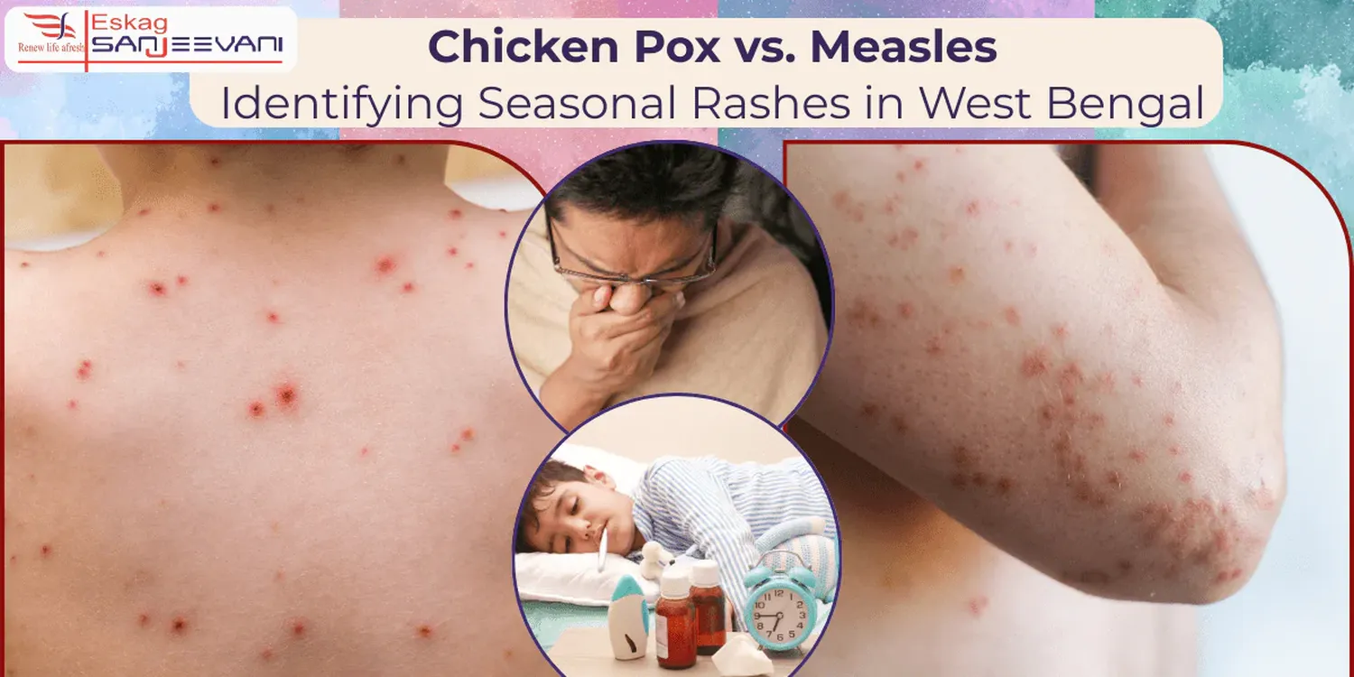 Visual comparison showing how to tell the difference between measles and a heat rash