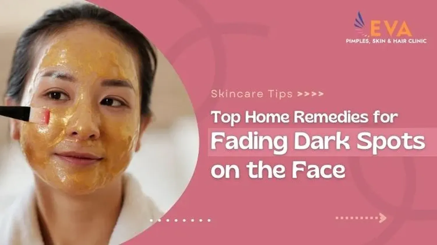 How to treat acne and dark spots naturally at home for African skin guide